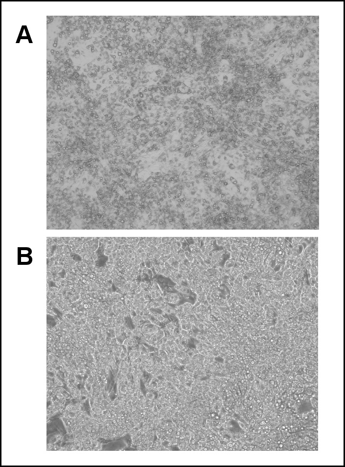 Figure 1 Lipid accumulation in 3T3-L1
