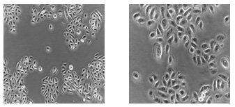 Human Keratinocytes