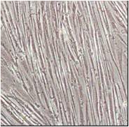 Skeletal Myocytes