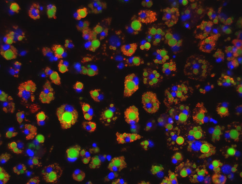 3T3-Li murine adipocytes