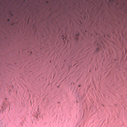 Human Dermal Fibroblast