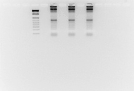 rna