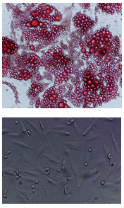 Subcutaneour Adipocytes